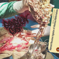 Ganglion Cyst - Aberrant Recursive Ingestion Of Infectious Malformations [ep] (2019)